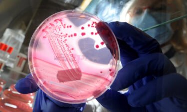 At least 1.27 million people died in 2019 due to drug-resistant bacterial infections
