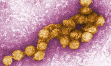 An electron micrograph of the West Nile virus is shown. New York City reported two human cases of the virus on August 16.