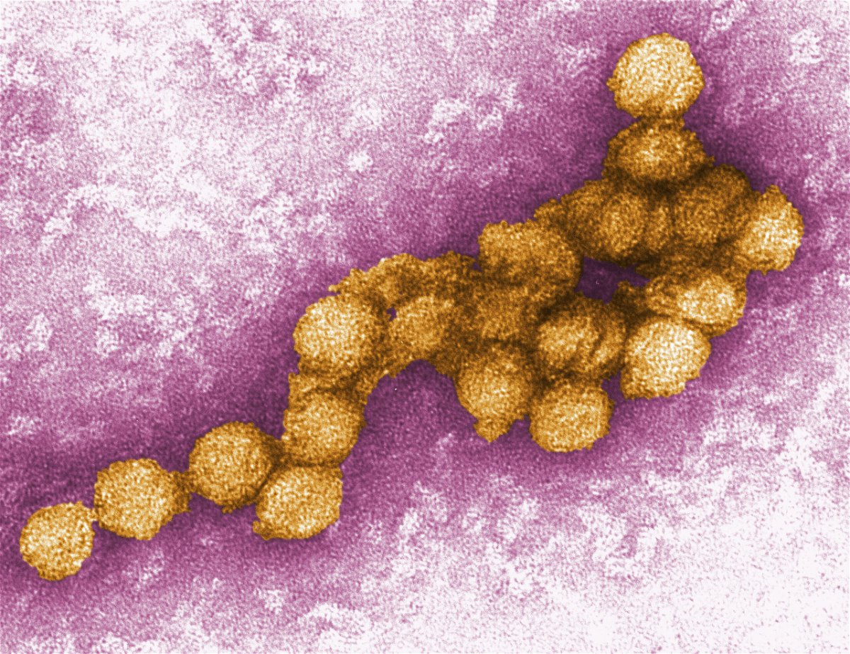 <i>Cynthia Goldsmith/CDC</i><br/>An electron micrograph of the West Nile virus is shown. New York City reported two human cases of the virus on August 16.