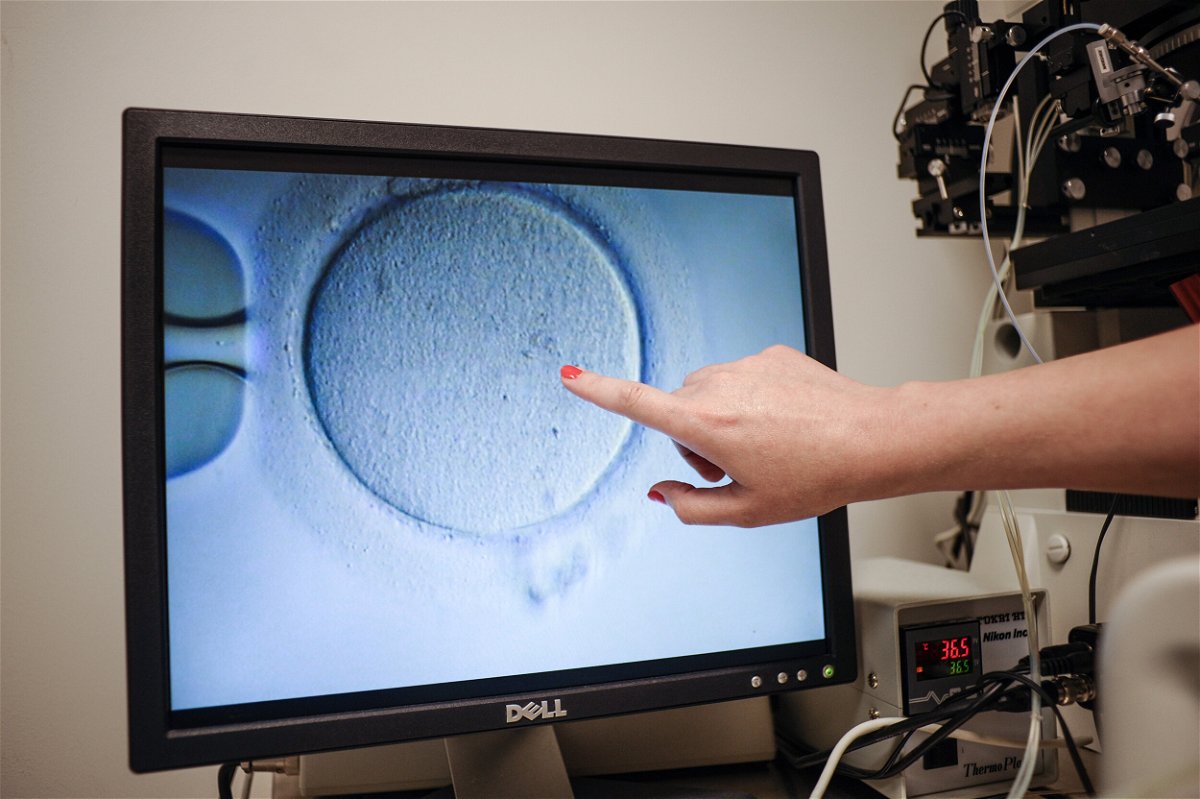 <i>Ivan Courounne/AFP/Getty Images/FILE</i><br/>An embryologist shows an Ovocyte after it was inseminated at the Virginia Center for Reproductive Medicine