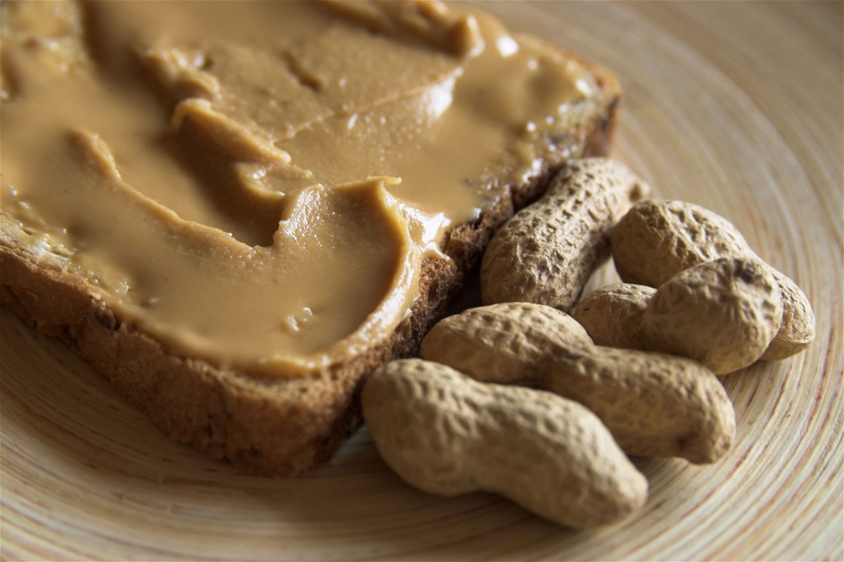 <i>Anna Dudek Photography/Moment RF/Getty Images</i><br/>An estimated 2.5% of US children may have peanut allergies