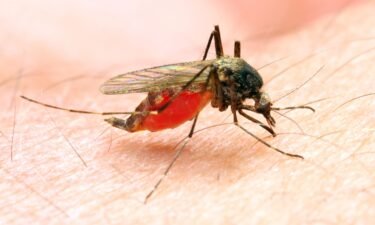 The US Centers for Disease Control and Prevention is warning doctors and public health officials about a handful of locally acquired cases of malaria. There hasn’t been a case of malaria caught locally in the US in 20 years.