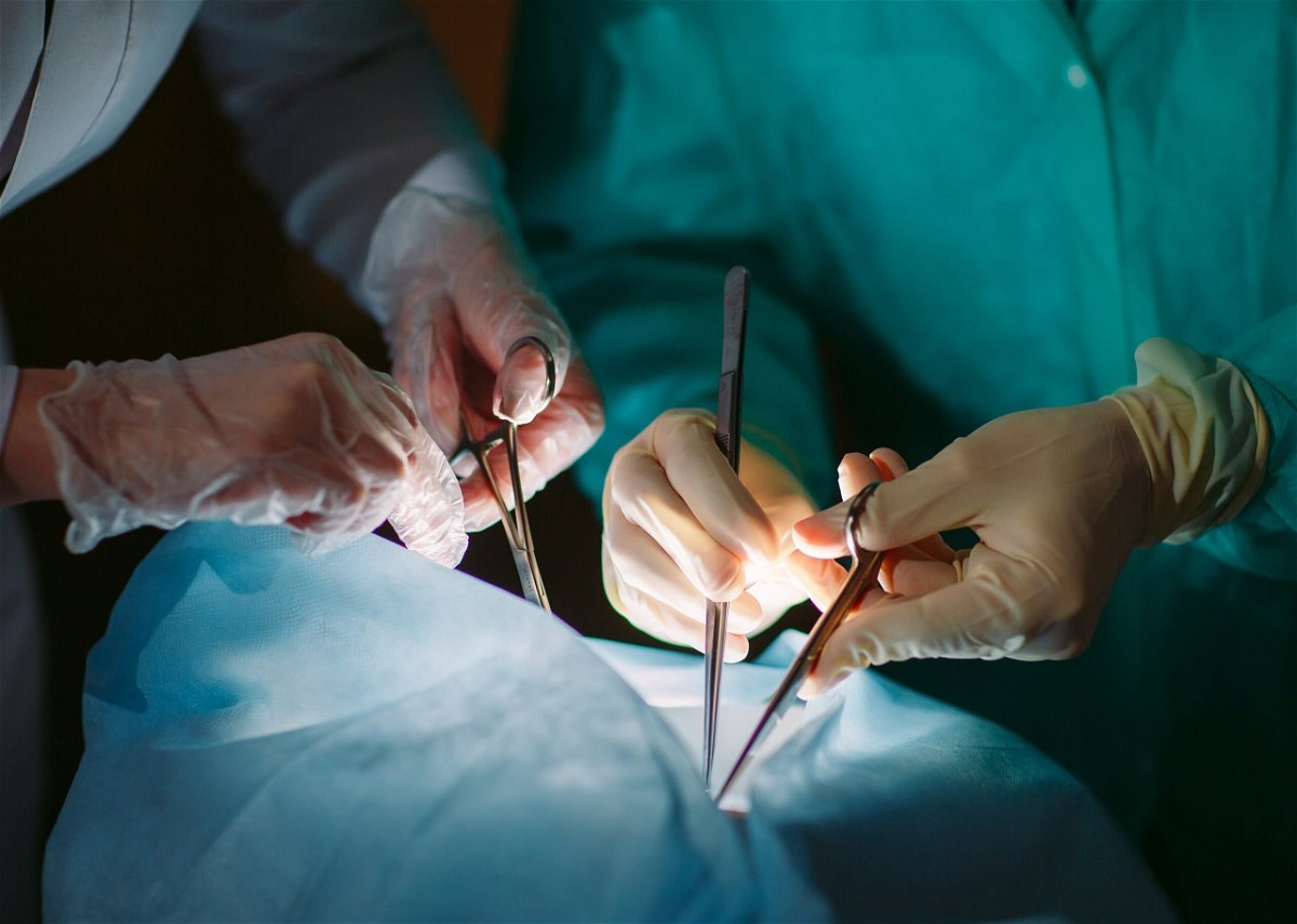 The US offers more organ-donor surgeries than ever