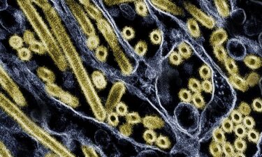 Four more health-care workers say they had respiratory symptoms after they tended to a hospitalized patient in Missouri who tested positive for H5N1 bird flu.