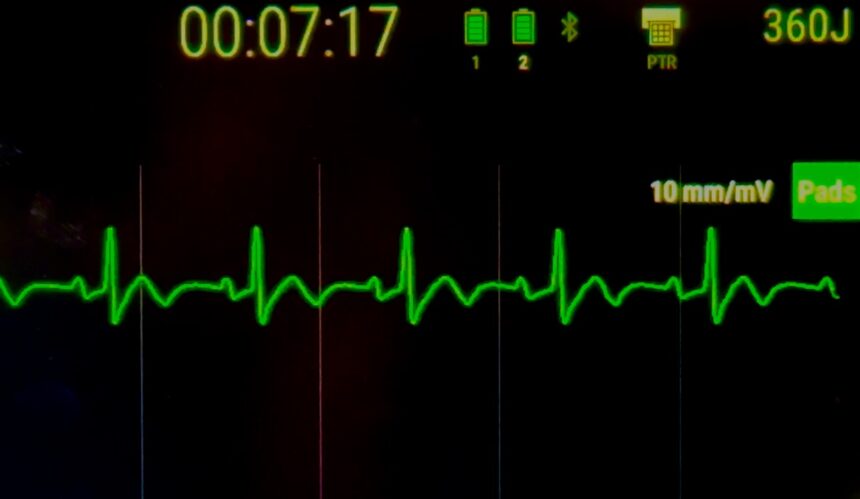 Ventura Fire becomes first in Southern California to Launch Innovative Cardiac Defibrillators